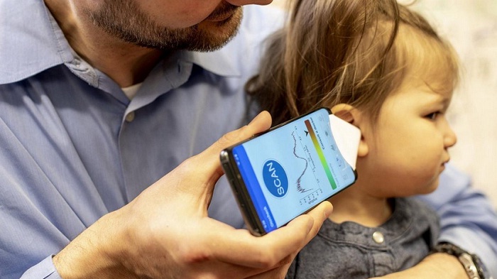 Makin Mudah, Cek Infeksi Telinga Kini Bisa dilakukan Lewat Smartphone